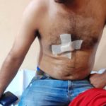 Vecinos reducen a joven que asaltó y acuchilló a motobolt