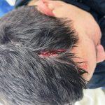 Hieren a un policía durante partido en la Liga Luqueña